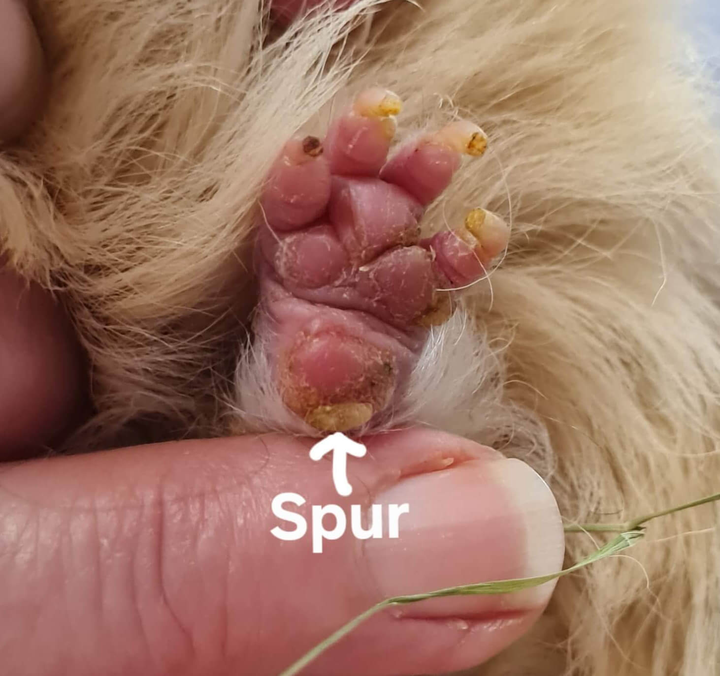 Example of a Foot Spur